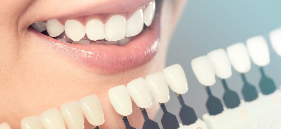 Cosmetic Dentistry – Rayen Dental Care