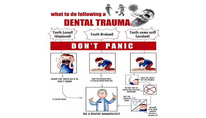 What to do following a Dental Trauma