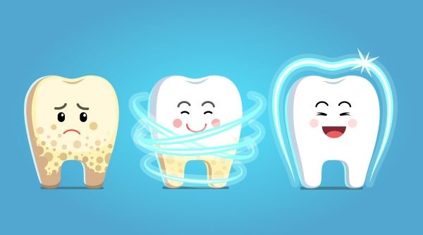 Fluoride Gel – Rayen Dental Care