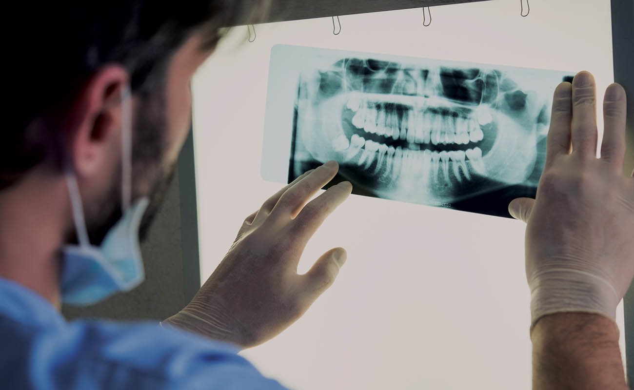 Usage of X-rays – Best Dentist in Chennai