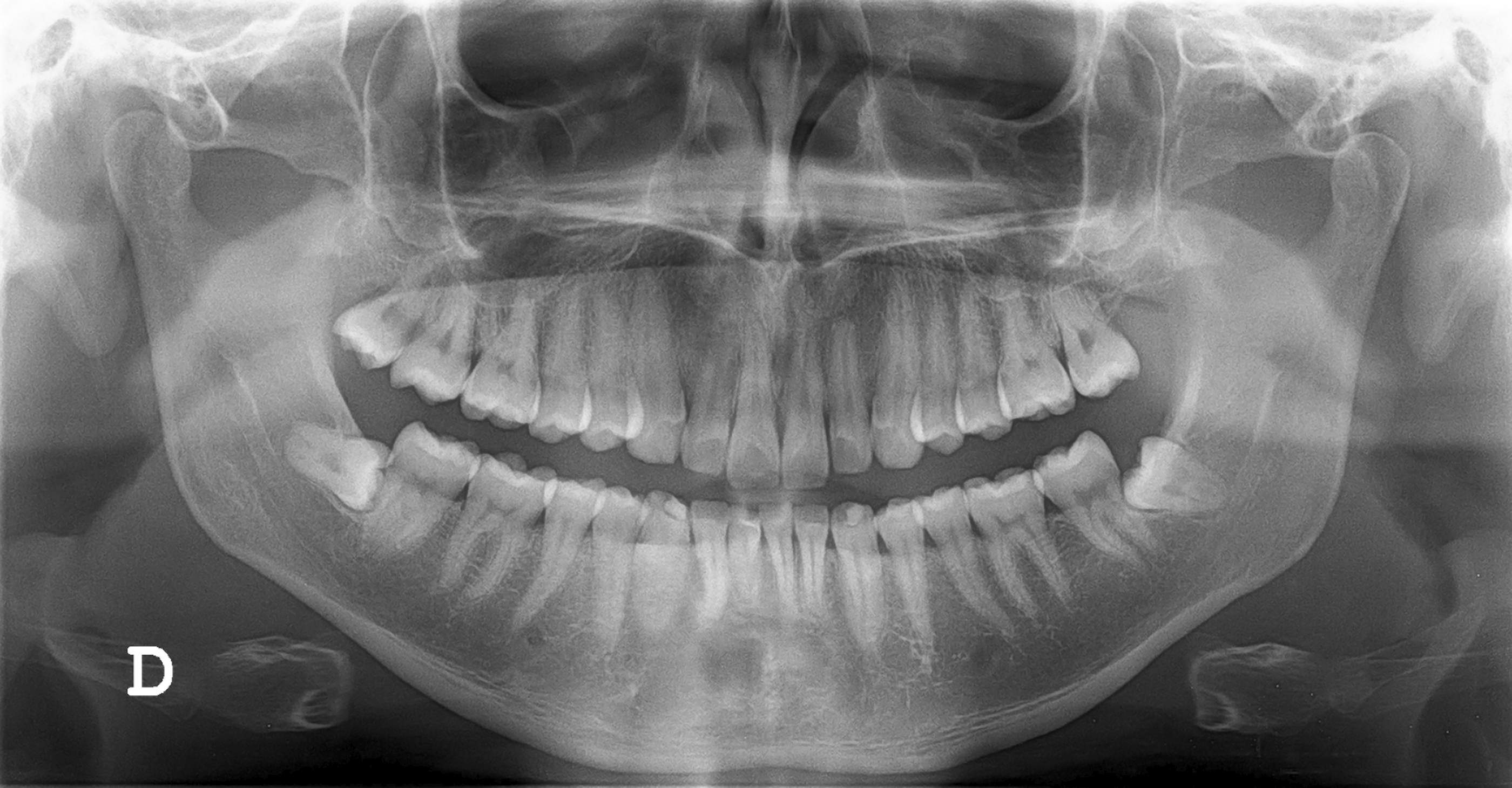x-rays in dentistry