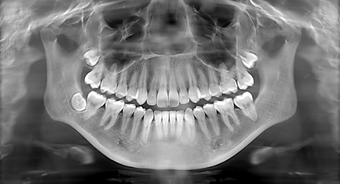 X-ray – Rayen Dental Care Centre