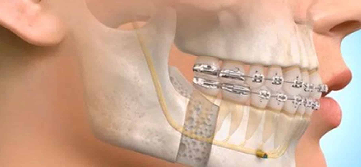 Oral and Maxiflofacial Surgery Chennai